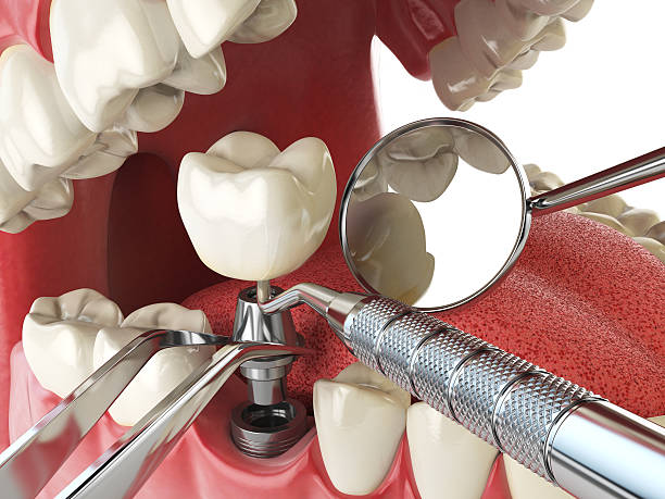 Best Emergency Dentist for Knocked-Out Tooth in Hampstead, NC